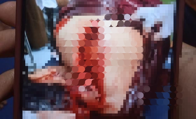 Suami di Dompu Bacok Istri Hingga Tewas, Kesal Dimarahi Saat Kondisi Lapar Habis Pulang Bekerja