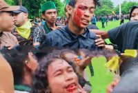 Seorang mahasiswa peserta aksi unjuk rasa  alami luka di bagian  alis mata dan giginya usai bentrokan antara massa dan aparat saat aksi Aliansi Pemuda Peduli Pariwisata (APIPI) di depan Kantor Bupati Lombok Timur, Kamis (22/01/2026). Demonstran tersebut diduga mengalami pemukulan saat pembubaran paksa aksi.