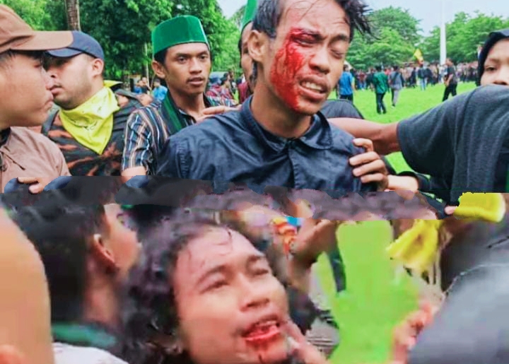 Seorang mahasiswa peserta aksi unjuk rasa  alami luka di bagian  alis mata dan giginya usai bentrokan antara massa dan aparat saat aksi Aliansi Pemuda Peduli Pariwisata (APIPI) di depan Kantor Bupati Lombok Timur, Kamis (22/01/2026). Demonstran tersebut diduga mengalami pemukulan saat pembubaran paksa aksi.