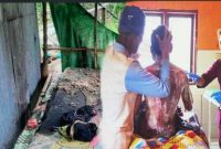 Rumah di Dusun Pisang Kemang, Desa Sepakat, Kecamatan Plampang, Kabupaten Sumbawa, tempat peristiwa terjadi dan Korban Dirawat – MI (25) menjalani perawatan intensif di RSUD Sumbawa akibat luka bakar serius.