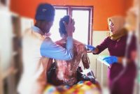 Korban Dirawat-MIL (26) menjalani perawatan medis akibat luka bakar serius di RSMA Sumbawa.