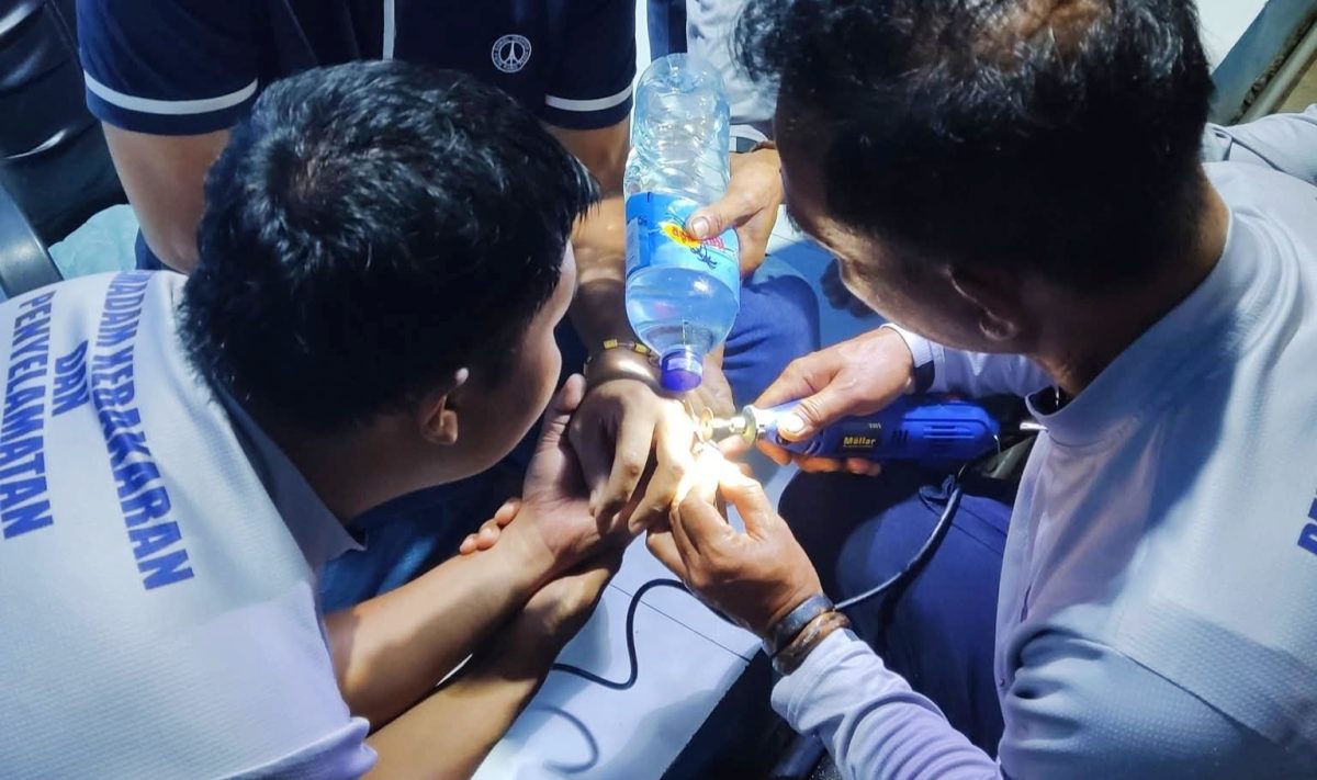 Petugas Damkar Sumbawa saat melakukan evakuasi cincin yang tersangkut di jari warga menggunakan alat pemotong khusus, Minggu (22/2/2026).