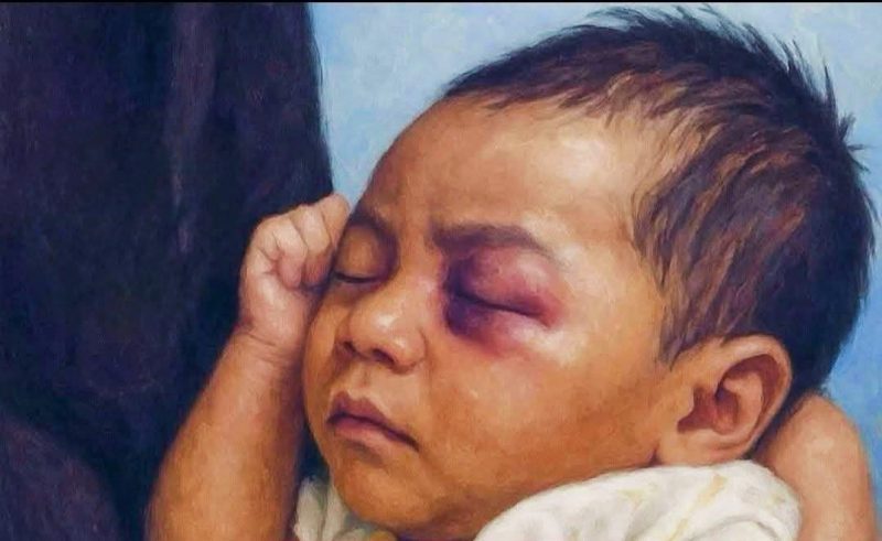 Seorang Bayi yang menjadi korban kekerasan sebagai representasi tingginya kasus kekerasan terhadap Anak yang masih terjadi dan menjadi perhatian serius Pemerintah.